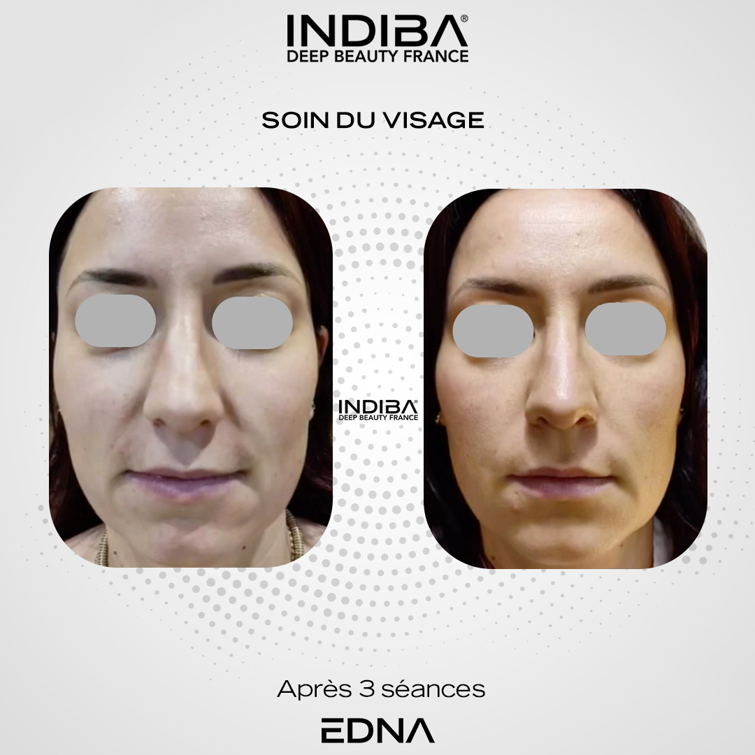 Soin du visage 10